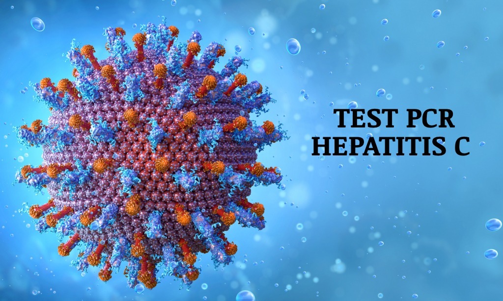 TEST PCR HEPATITIS C